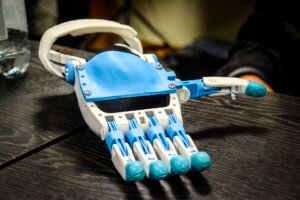 1% podatku, rehabilitacja, druk 3d, #RĘKA3D, Fundacja Otwarte Ramiona