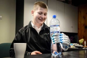 1% podatku, rehabilitacja, druk 3d, #RĘKA3D, Fundacja Otwarte Ramiona