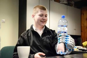 1% podatku, rehabilitacja, druk 3d, #RĘKA3D, Fundacja Otwarte Ramiona