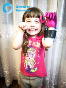 3d druk, #Ręka3d, 3D , skan, Fundacja Otwarte Ramiona