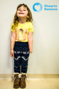 3d druk, #Ręka3d, 3D , skan, Fundacja Otwarte Ramiona