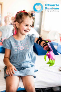 3d druk, #Ręka3d, 3D , Fundacja Otwarte Ramiona