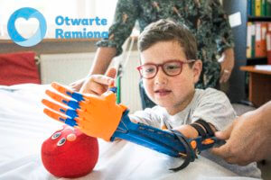 druk 3d, #Ręka3D, Fundacja Otwarte Ramiona